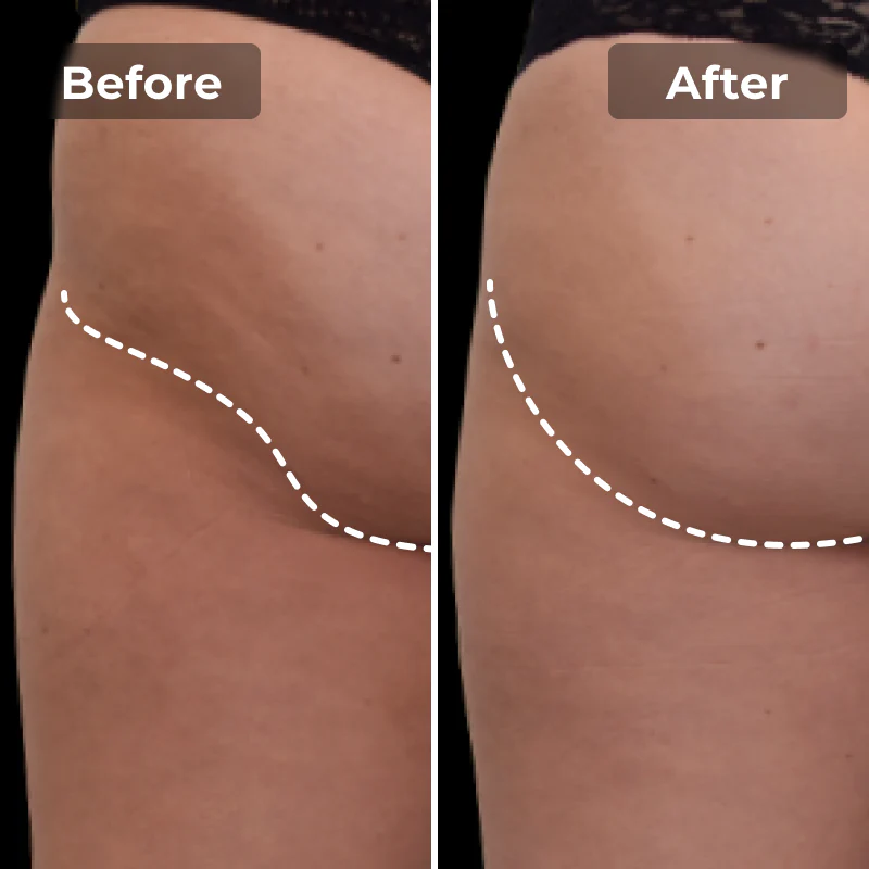 NeuroPulse Sculpt™